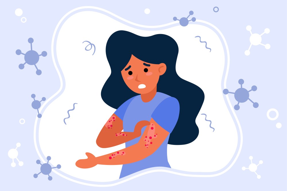 Tick Bites Red Meat Allergy: Prevention Tips