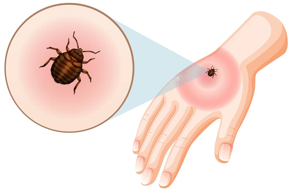 Protecting Your Family from Lyme Disease Through Proper Tick Control in Vancouver