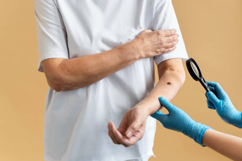 Protecting Your Family from Lyme Disease Through Tick Control in Chatham