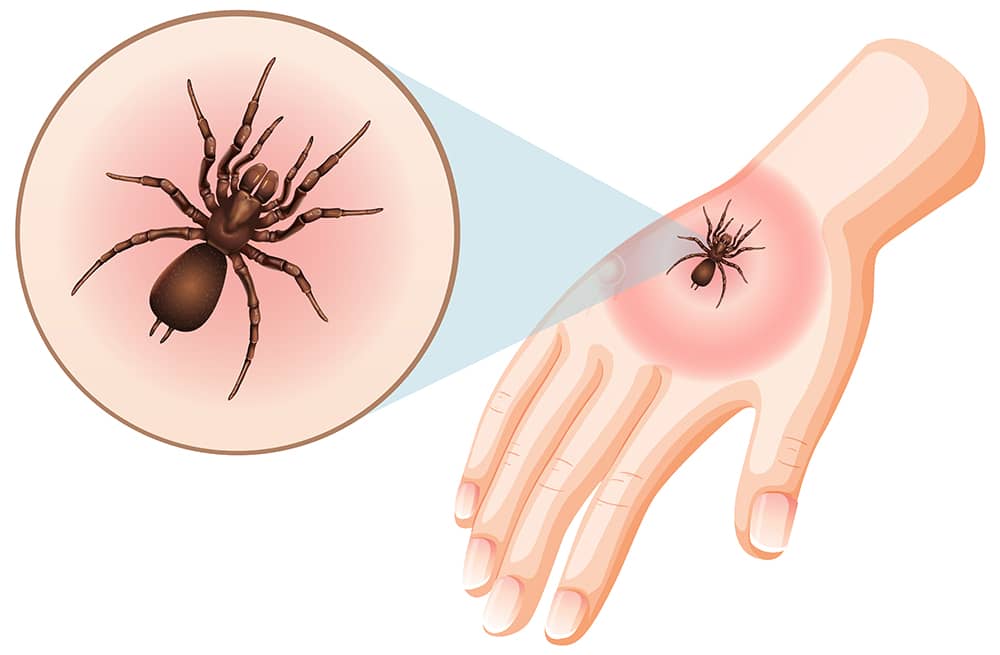 Protecting Your Family from Lyme Disease Through Tick Control in Hamilton