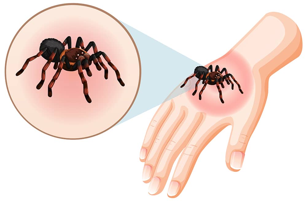 Protecting Your Family from Lyme Disease Through Tick Control in Muskoka