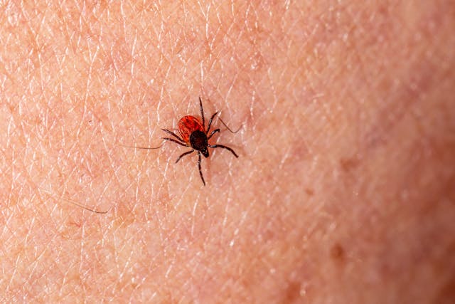 Protecting Your Family from Lyme Disease Through Tick Control in Oakville
