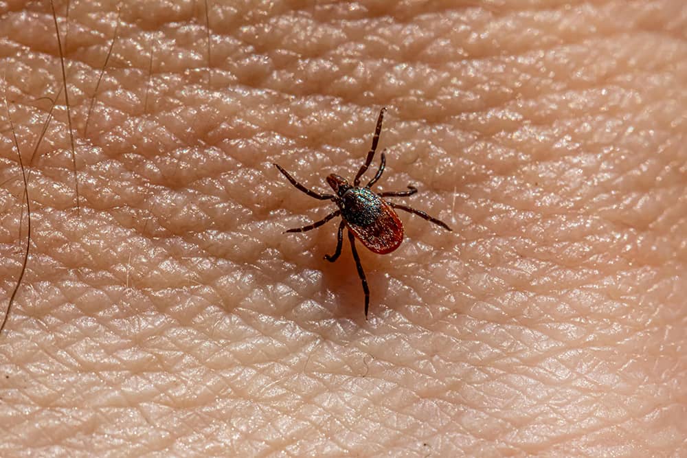 Lyme Disease and Tick Control in Windsor Ontario | Mosquito Man