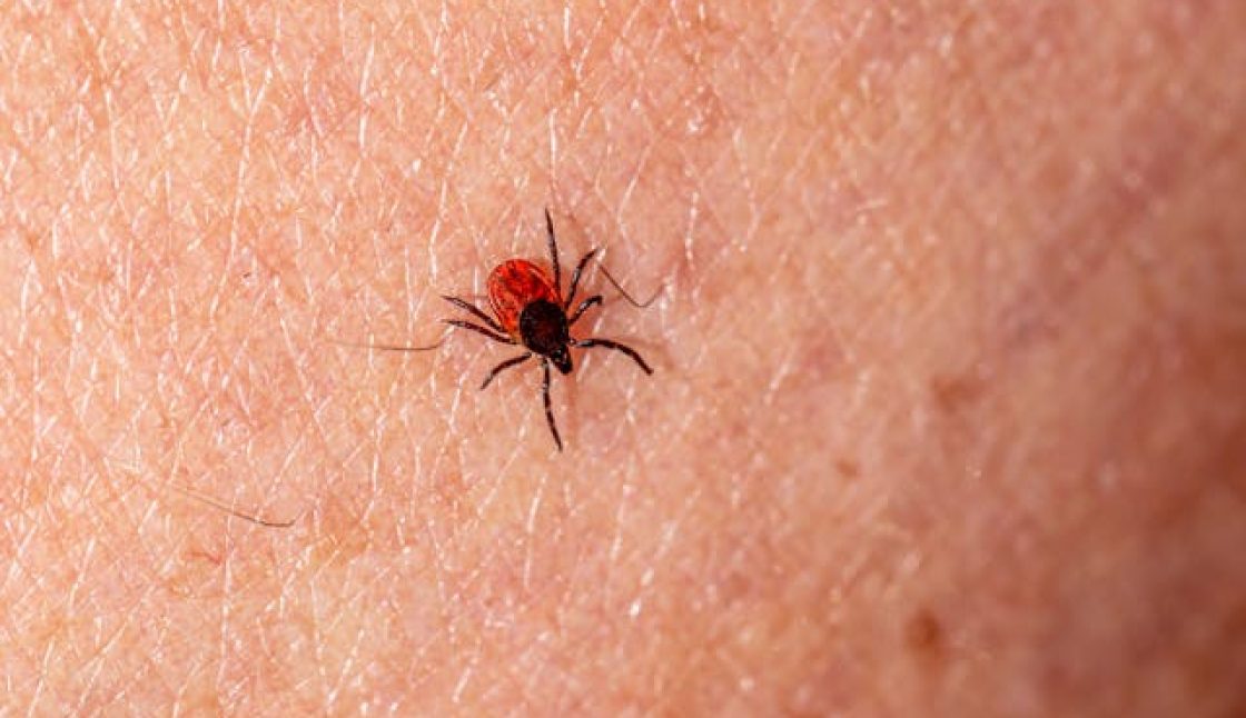 Protecting Your Family from Lyme Disease Through Tick Control in Oakville