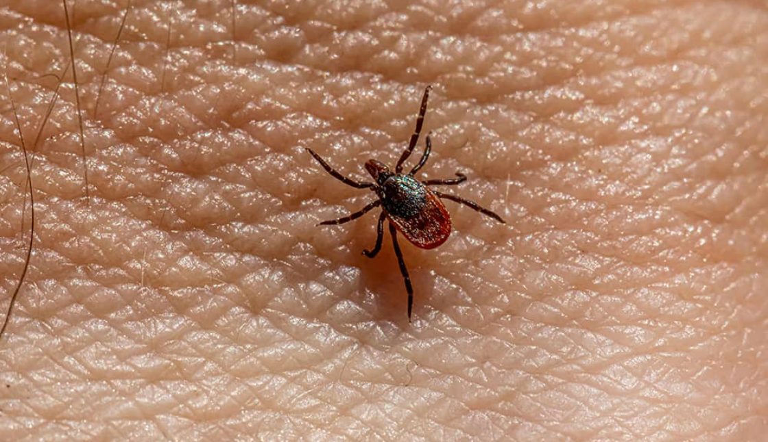Lyme Disease and Tick Control in Windsor Ontario | Mosquito Man